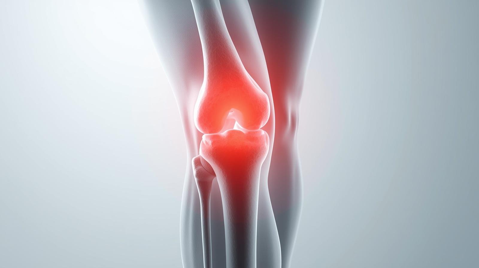 دليل شرائح ومسامير العظام: أنواعها، طرق التثبيت ومدة الالتئام